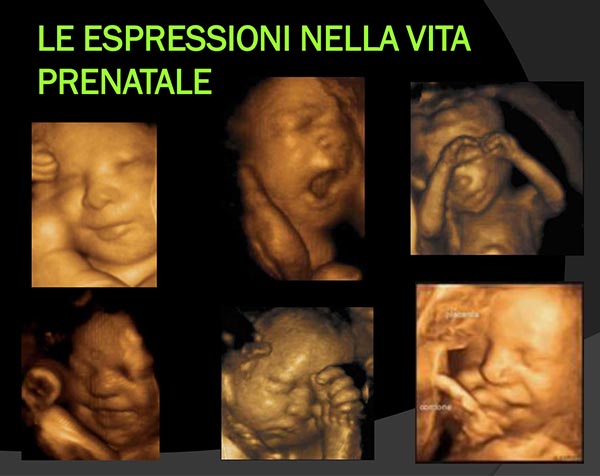 21_vita_prenatale_espressioni-vita-prenatale